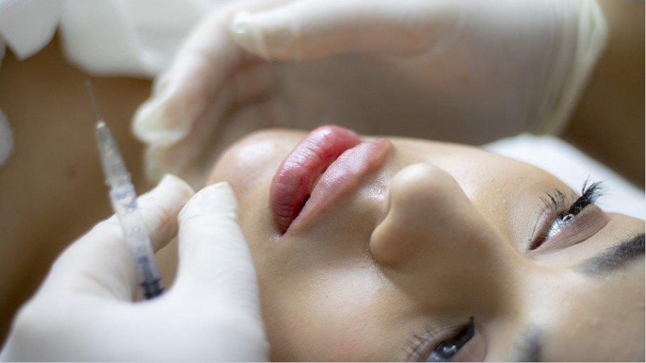 Voici 10 conseils pour obtenir la meilleure injection de remplissage pour les lèvres